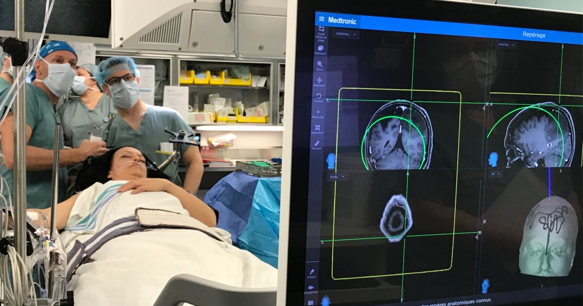 Operation cerveau David Fortin